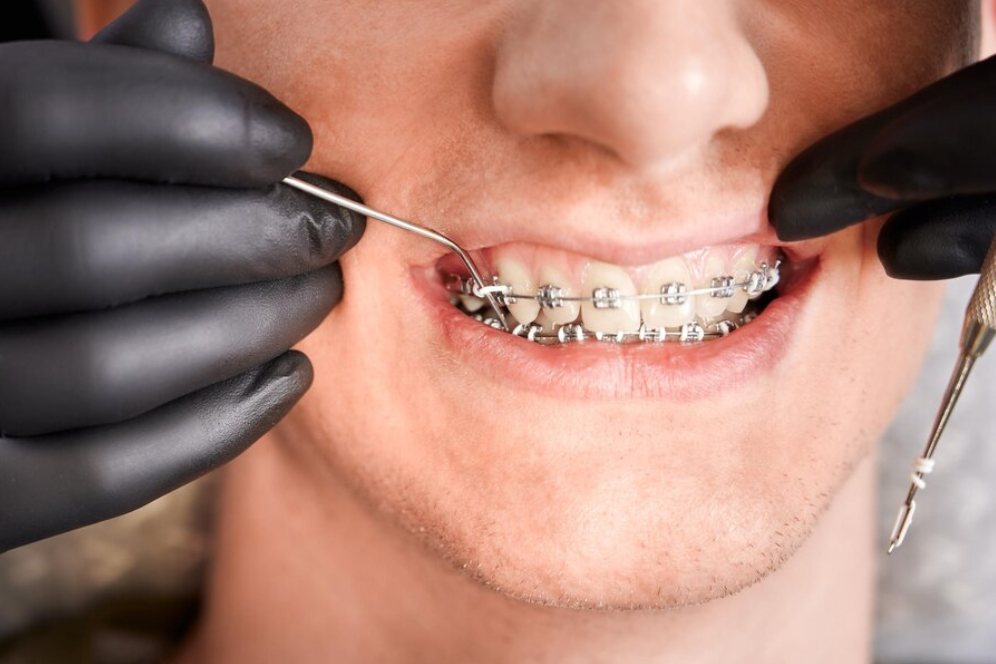 Orthodontist placing rubber bands on male patient braces male pediatrician doing vaccination to baby boy with a syringe in the hospital